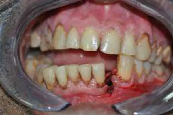 Punnagaiy Dental Clinic