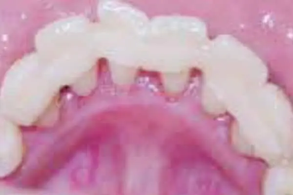 Punnagaiy Dental Clinic