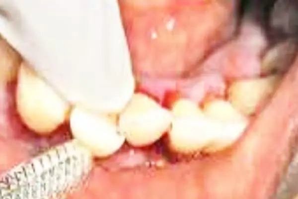 Punnagaiy Dental Clinic