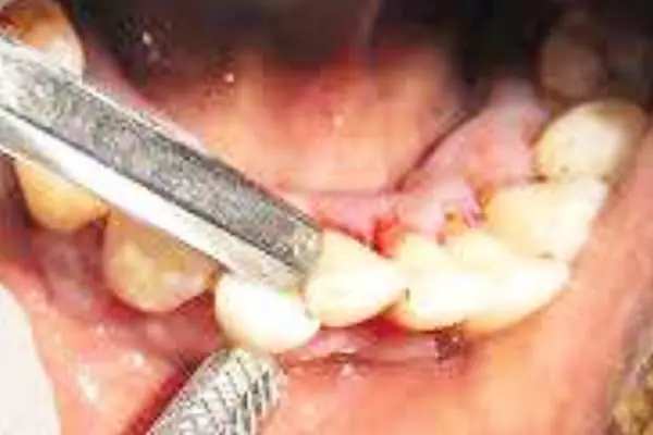 Punnagaiy Dental Clinic