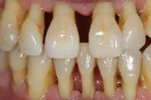 Punnagaiy Dental Clinic