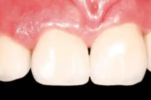 Punnagaiy Dental Clinic