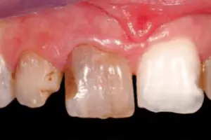 Punnagaiy Dental Clinic