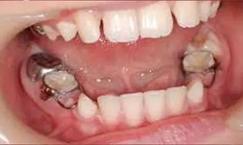 Pediatric-Dentistry1
