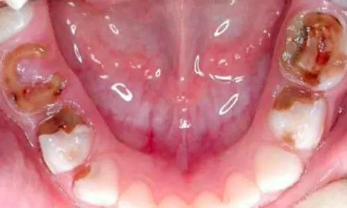 Pediatric-Dentistry3