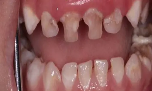 Pediatric-Dentistry4