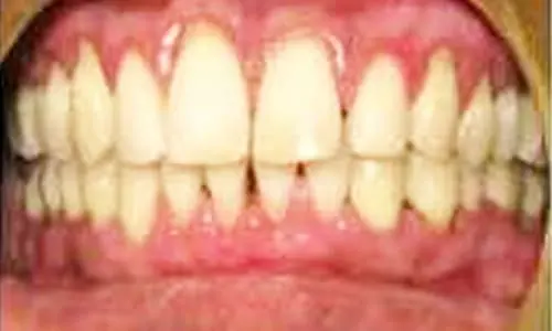 periodontics8