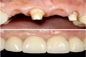 Removable-Appliance-8