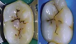 restorative7jpg
