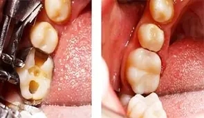 restorative9