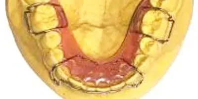 retainer10
