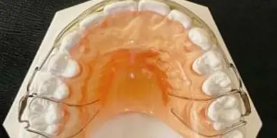 Retainers9