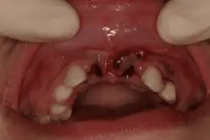 Punnagaiy Dental Clinic
