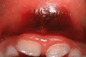 Punnagaiy Dental Clinic