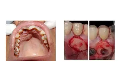 surgical1