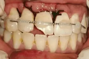 Punnagaiy Dental Clinic
