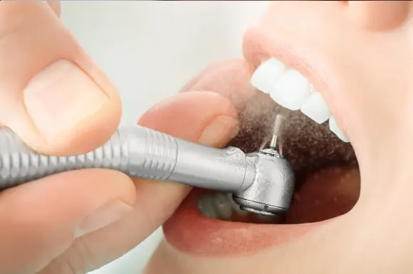 restorative-dentistry-home